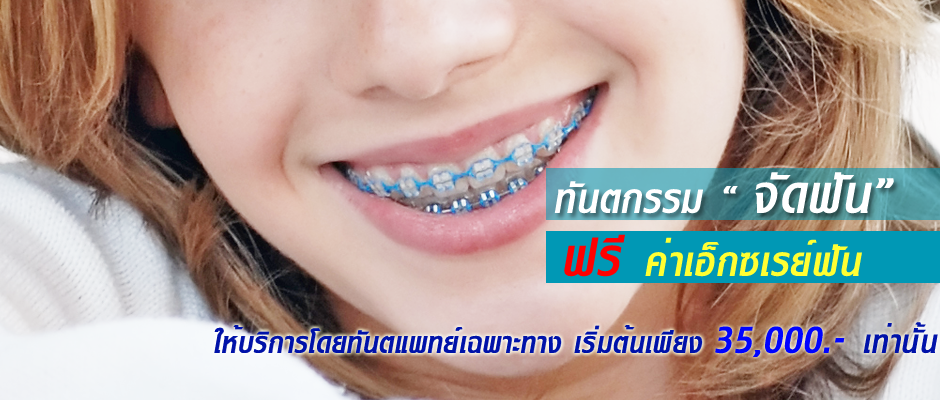 ทันตกรรมจัดฟัน